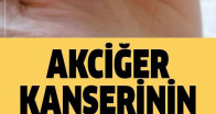Akciğer Kanserinin Sinsi Belirtisi