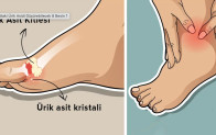 Ayaklardaki Ağrının Sebebi