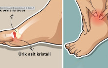Ayaklardaki Ağrının Sebebi