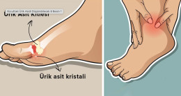 Ayaklardaki Ağrının Sebebi