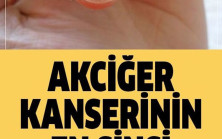 Akciğer Kanserinin Sinsi Belirtisi