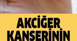 Akciğer Kanserinin Sinsi Belirtisi