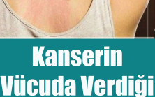 Kanserin Vücuda Verdiği 10 Belirti