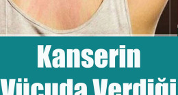Kanserin Vücuda Verdiği 10 Belirti