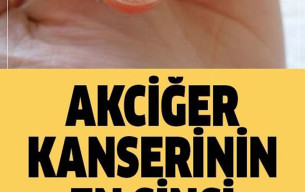 Akciğer Kanserinin Sinsi Belirtisi
